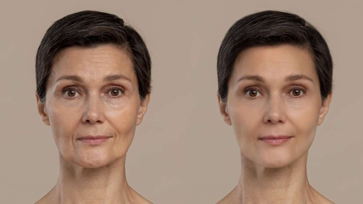 Anti-aging Skin Treatments